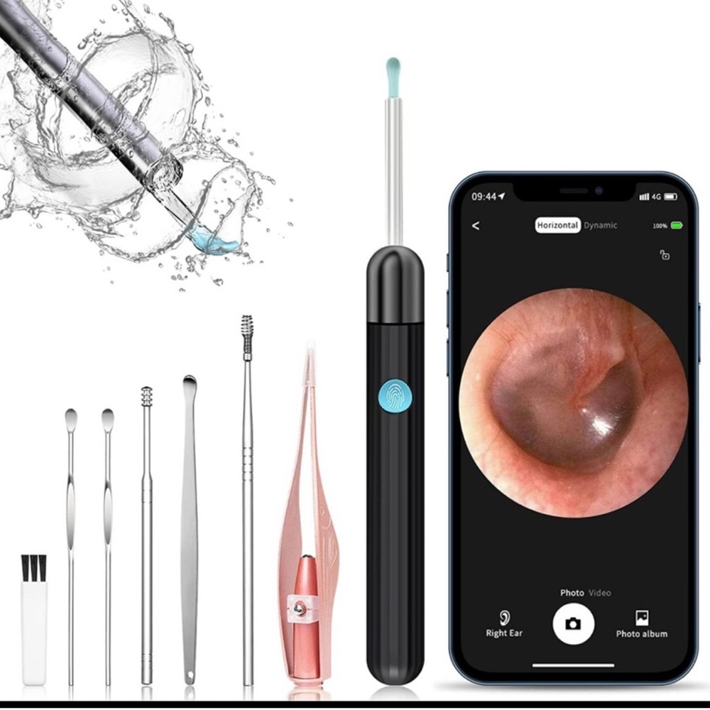 Ear Wax Removal, Ear Cleaner Camera with 1080P, 6 Ear Pick, 8 Pcs Ear Set White - Picture 1 of 8